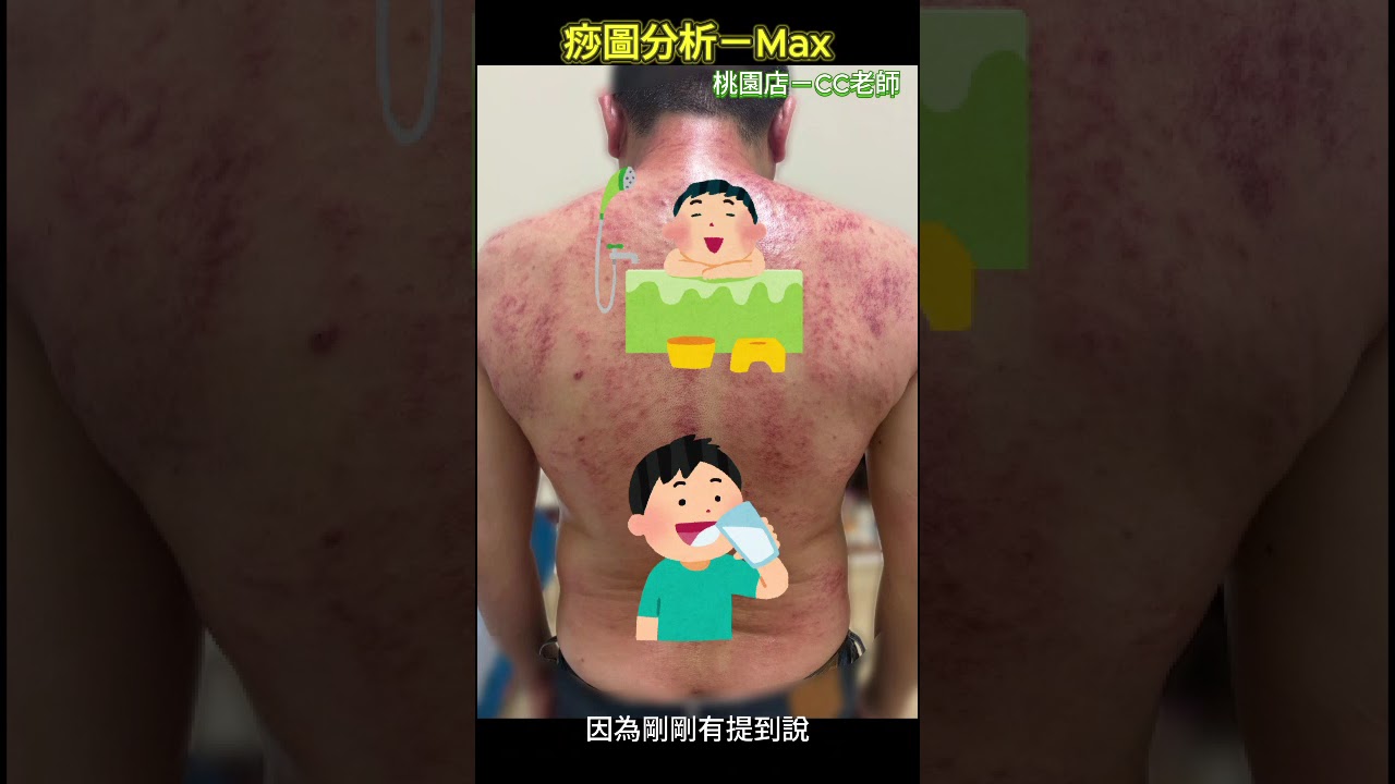 便便總是一小條!快看是不是褲頭太緊?feat. 桃園總店 Max 縮圖