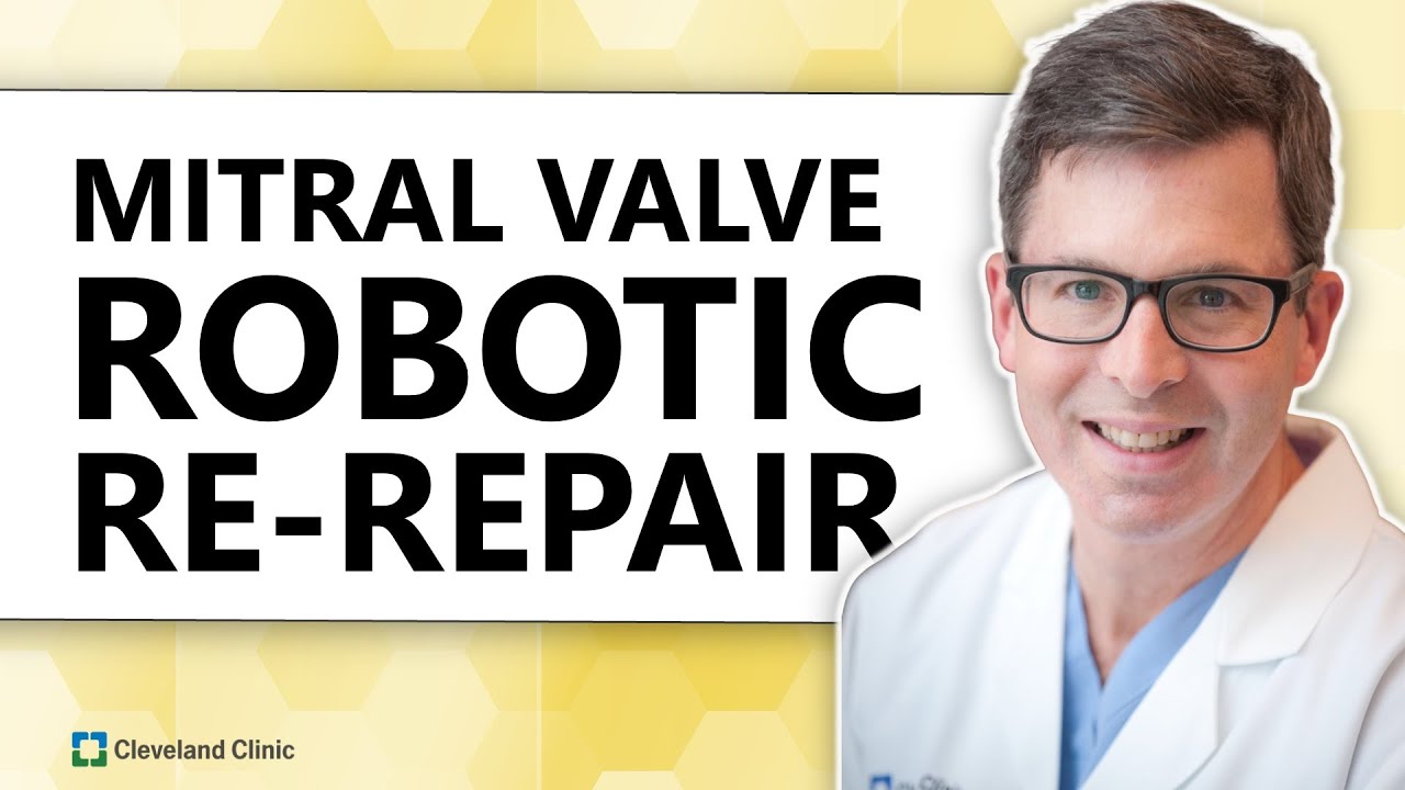 Вопросы и ответы хирургов: Роботизированная реконструкция митрального клапана: возможно ли это?
