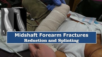 Reduction & Splinting of Forearm Fractures--Quick Version