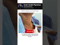 The Exact Technique Doctors Use #medical #procedure #shorts #shortsviral #healthtips #ytviral