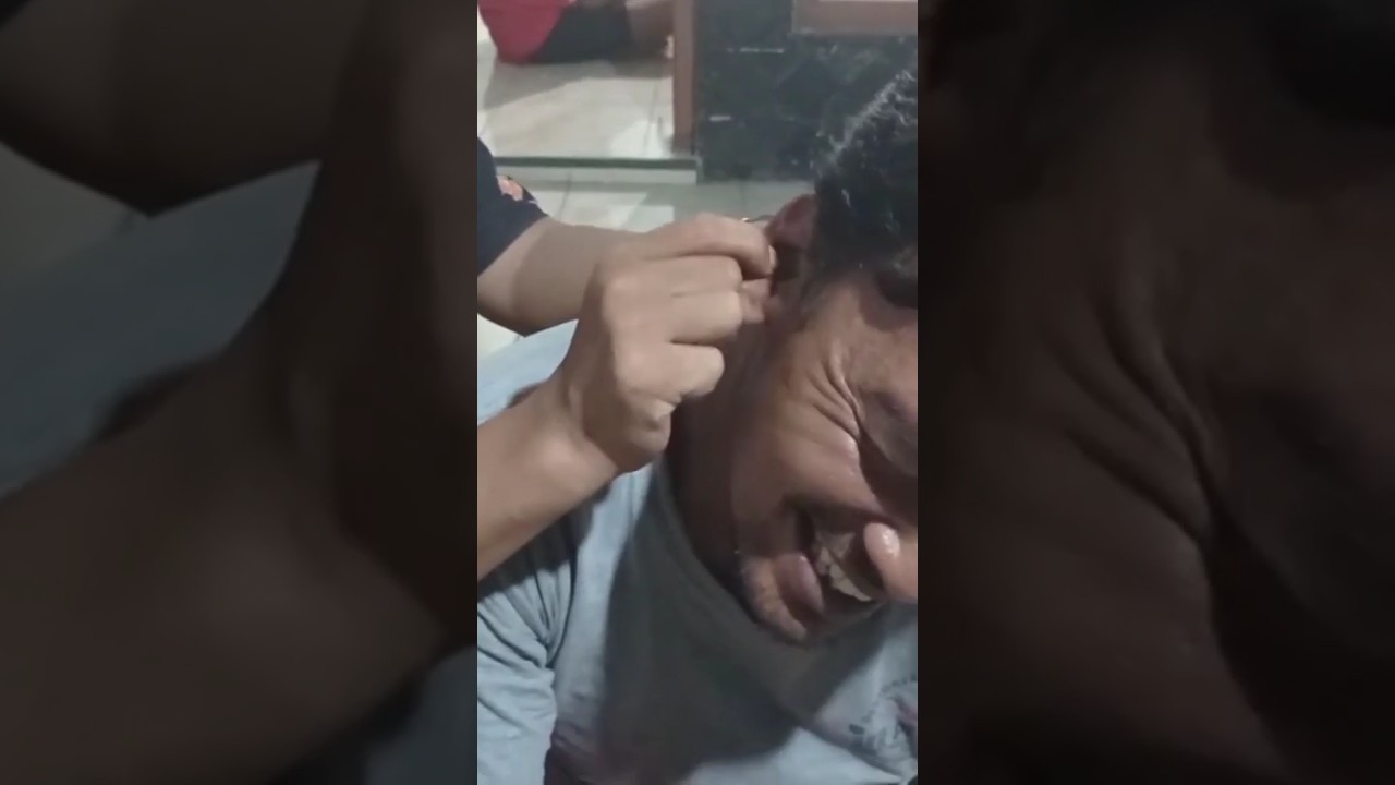 Cara pijat untuk lupa ingatan