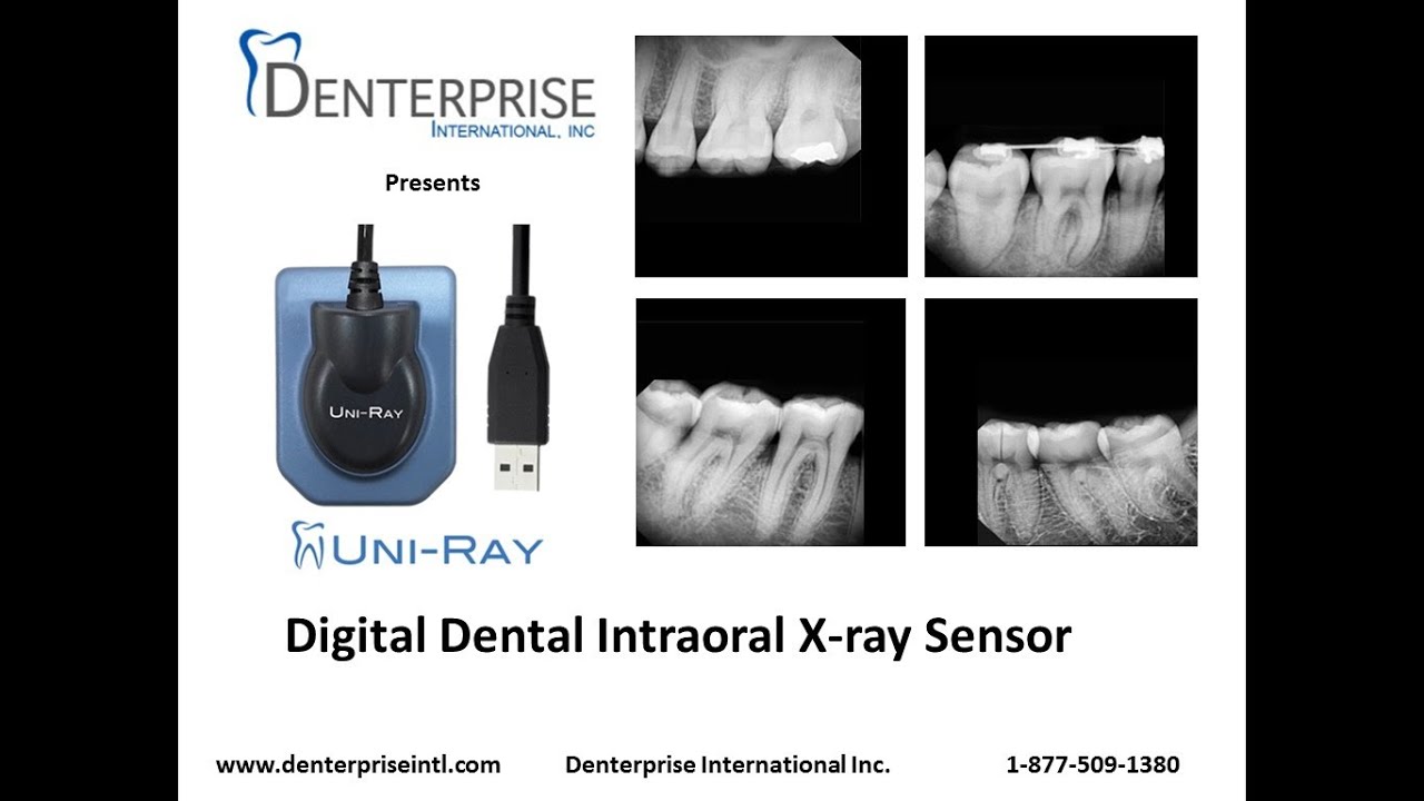 UniRay Digital Dental X-ray Sensor Intro