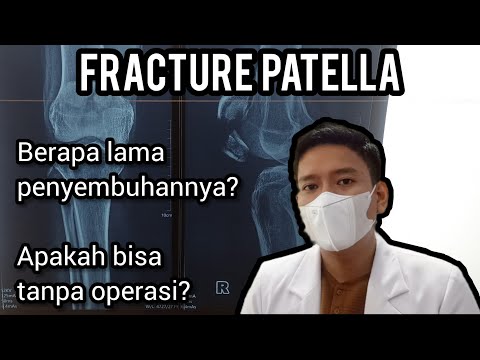 Penanganan Cedera Patah Tulang Tempurung Lutut (Fracture Patella)