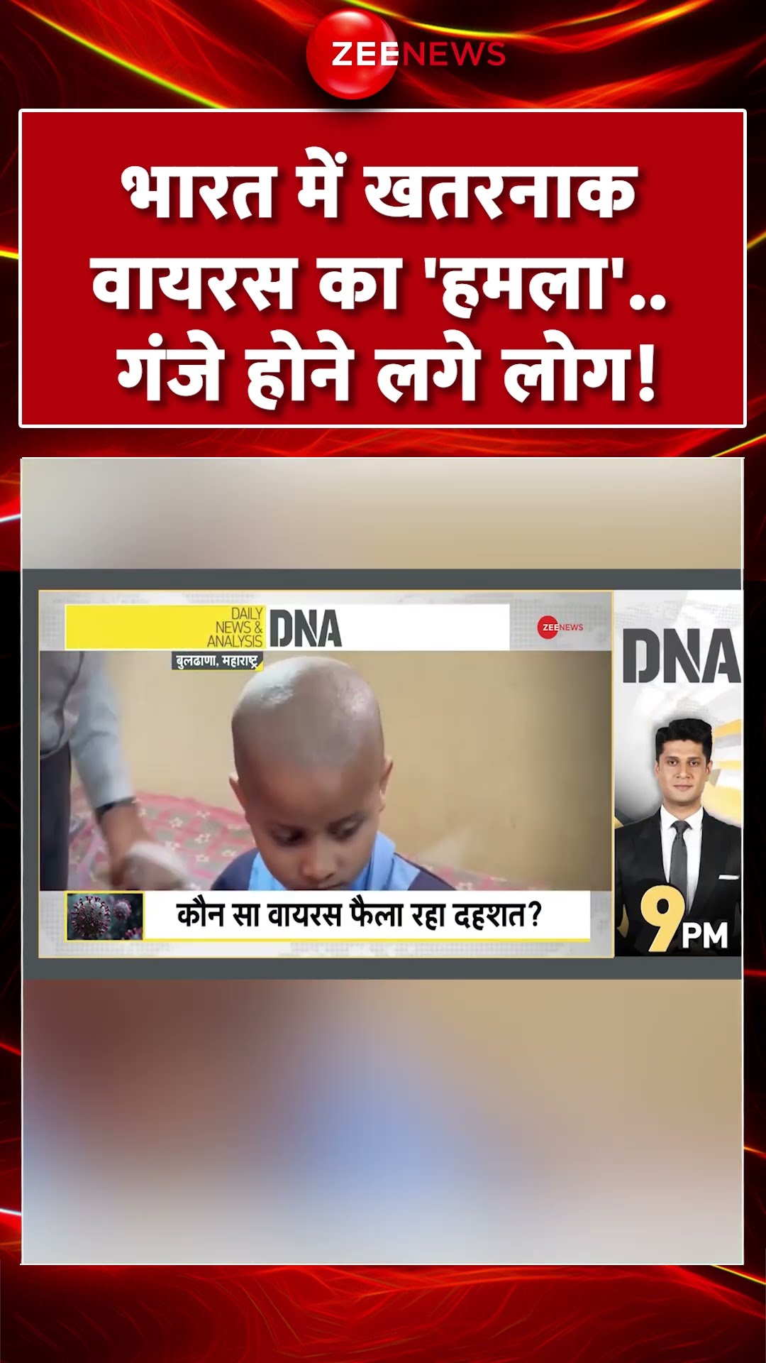 #shorts : #india में खतरनाक वायरस का 'हमला'.. गंजे होने लगे लोग! #hmpvirus #breakingnews #hairfall