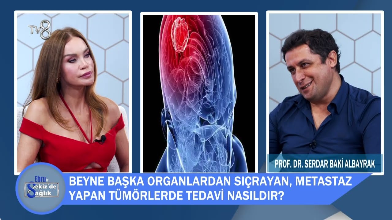 Bu Baş Ağrıları Beyin Tümörü Habercisi mi? | Dr. Serdar Baki Albayrak | TV8