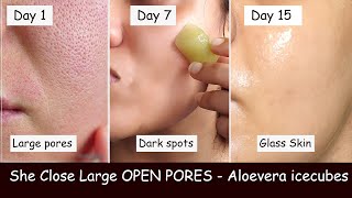 She rubs Aloevera ice cubes Daily \& Closed LARGE OPEN PORES | Damaged Skin Repair | Skin whitening