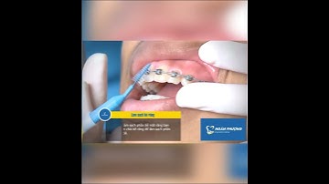 nha khoa Ngân Phượng - VỆ SINH RĂNG NIỀNG sao cho đúng