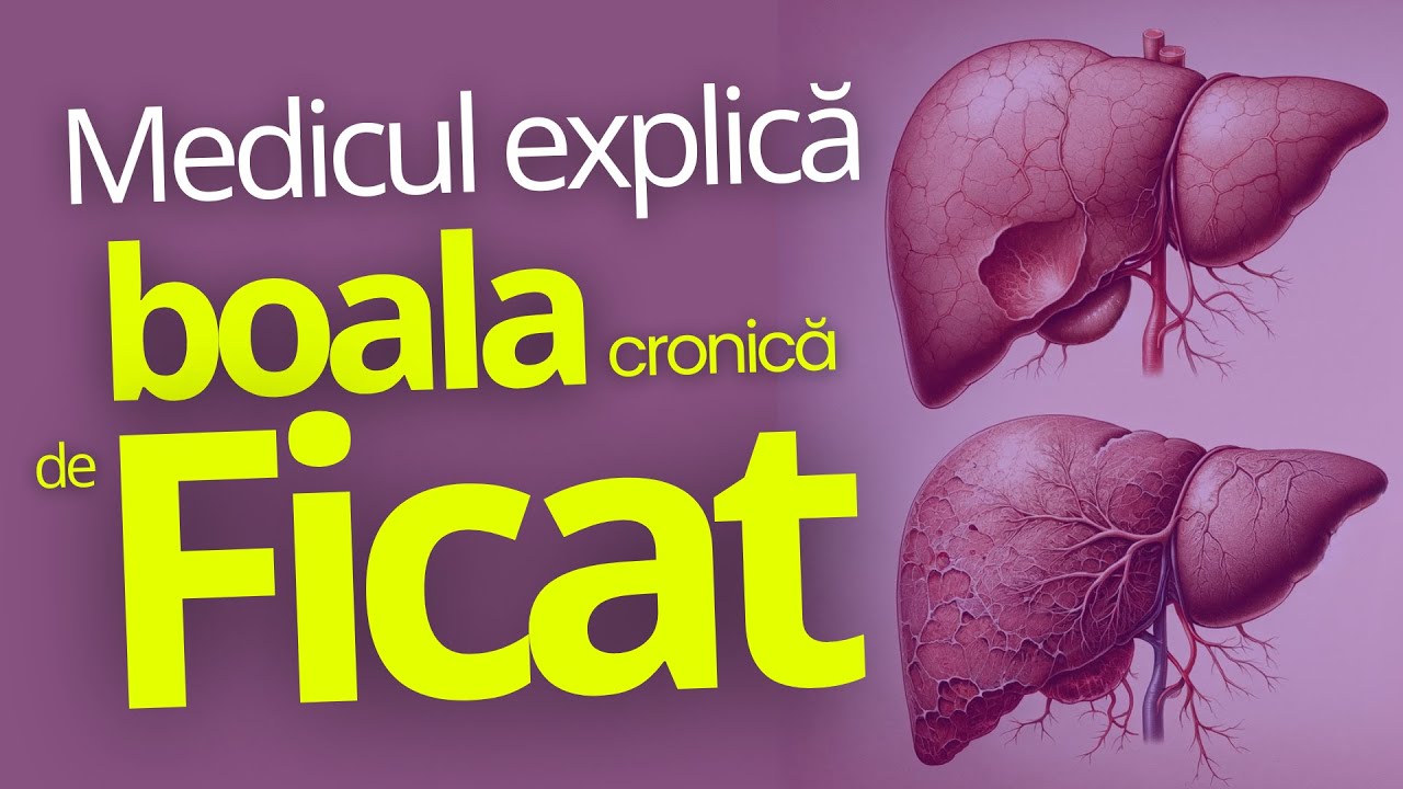 Ce e de făcut în Boala Cronică de FICAT