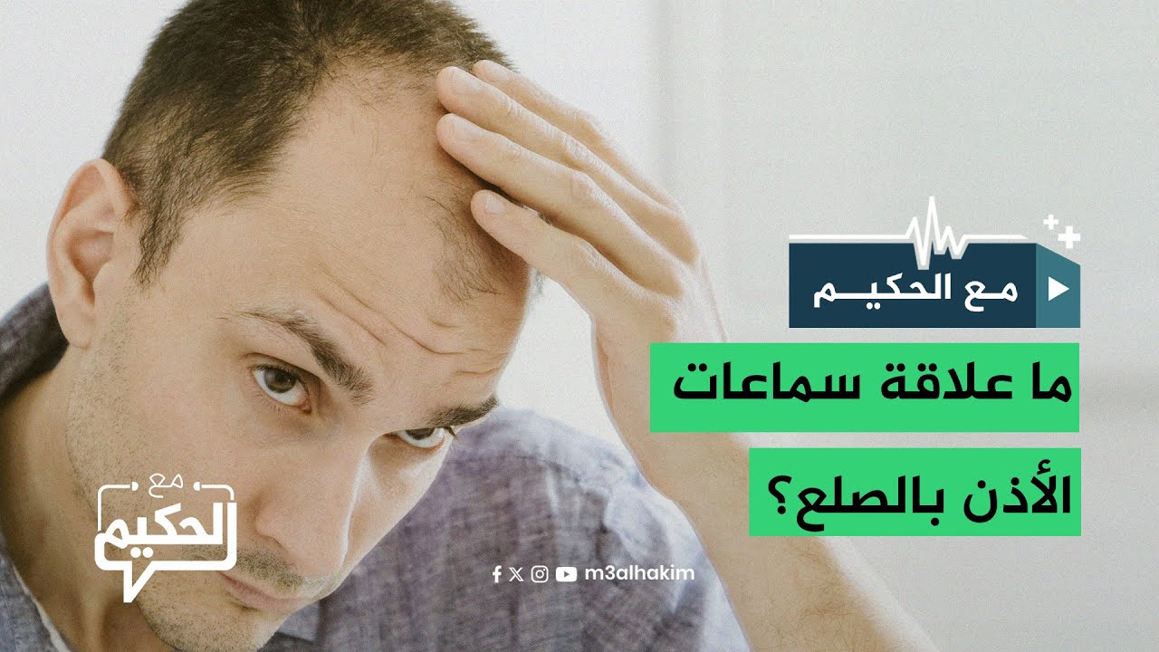 ما علاقة سماعات الأذن بالصلع؟