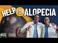 Help for Alopecia: Twins Regrow Hair After Going Vegan | Exam Room Podcast