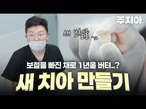 빠진 보철물을 다시 살릴 수 있을까? 유튜브 영상 썸네일
