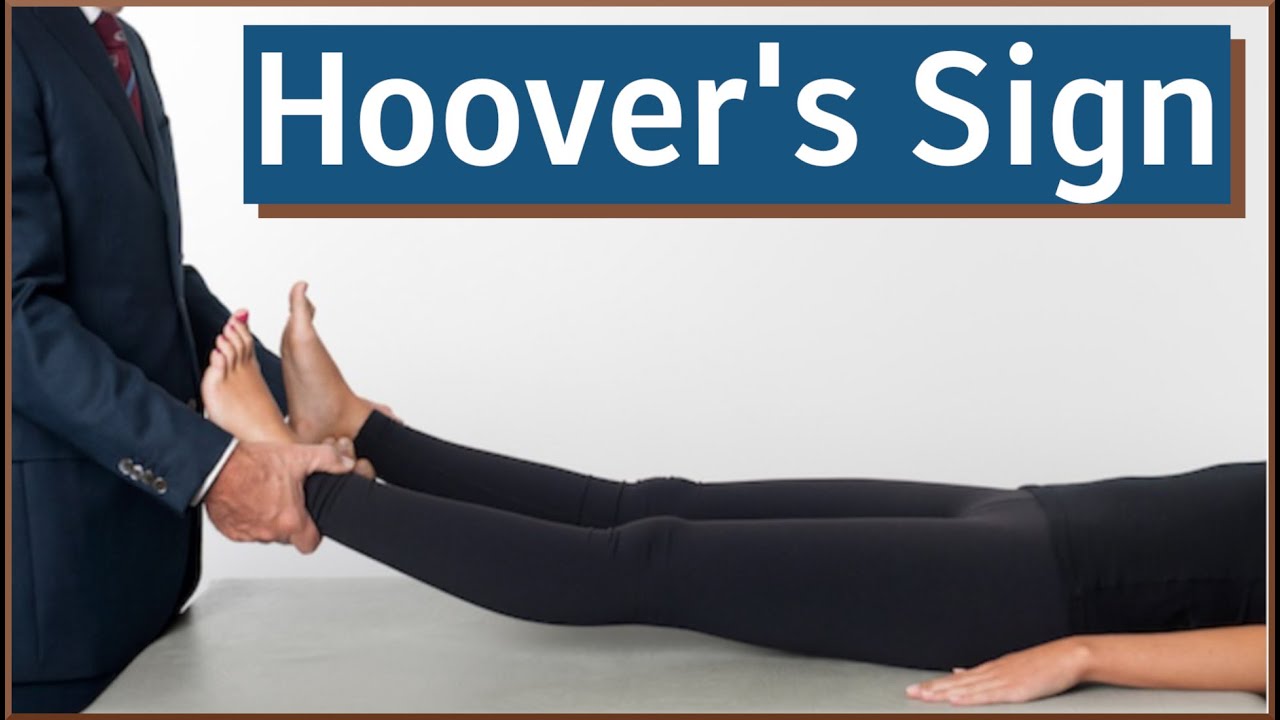 Hoover S Sign Of Functional Leg Weakness
