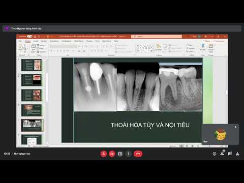 Video Bài giảng lâm sàng RHM - Viêm tủy răng, viêm cuống... - youtube