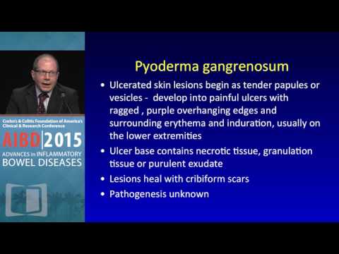 How Can We Better Manage Common Extraintestinal Manifestations of IBD