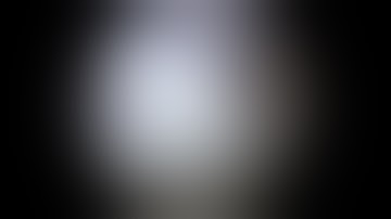 An Alternative Femoral Fixation in All-Inside Anterior Cruciate Ligament Reconstruction...