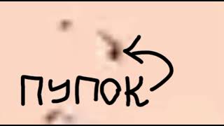 Дурацкий Йикссур | RYTP