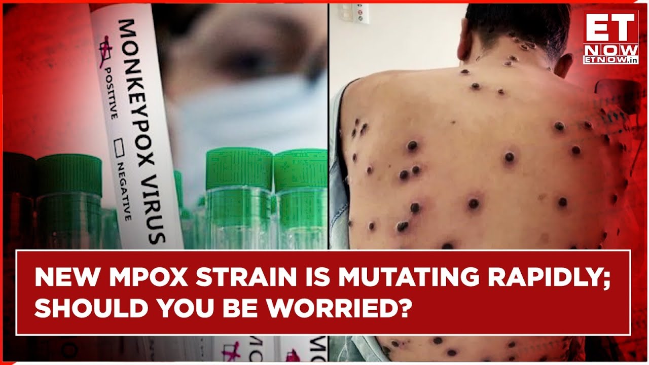 Mpox Virus: New Strain Mutating Rapidly, Say Scientists; India Develops  RT-PCR Test Kits | Mpox