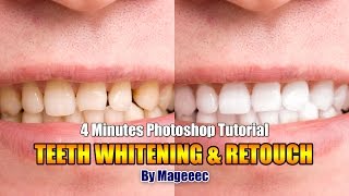 Teeth Whitening & Retouch 4 Minutes Photoshop Tutorial screenshot 4