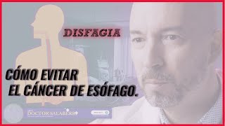 DISFAGIA. Cómo EVITAR CANCER de ESOFAGO