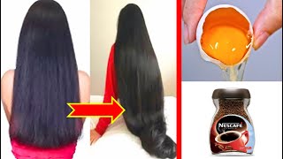 How to grow hair 2 cm in one day very fast || Super fast hair growth challenge-101% Effective
