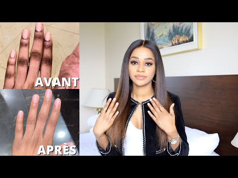 LA SOLUTION CONTRE LES QUINTOS, PIEDS, COUDES ET GENOUX FONCÉS -  HYPERPIGMENTATION⎮Maggy Kloset