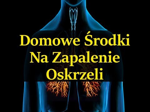 Wideo: Leczenie Zapalenia Płodu środkami Ludowymi W Domu