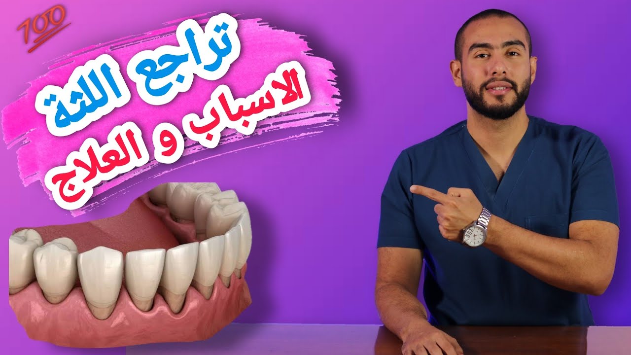 تراجع اللثه الأسباب والعلاج 👌💯| اسباب انحسار اللثه وعلاجها 🦷💥| علاج تراجع اللثه بدون جراحه 🥳