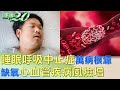 睡眠呼吸中止症萬病根源 缺氧心血管疾病風險增 健康2.0