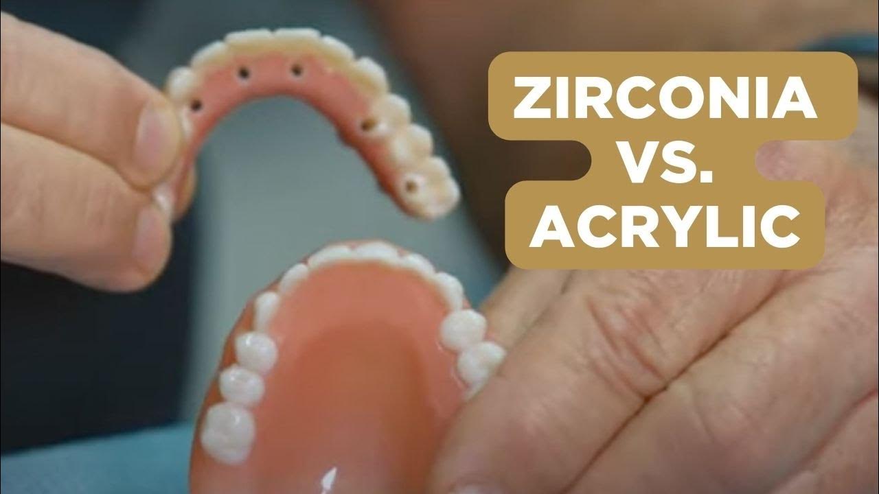 Zirconia vs. Acrylic Material New Teeth Now YouTube