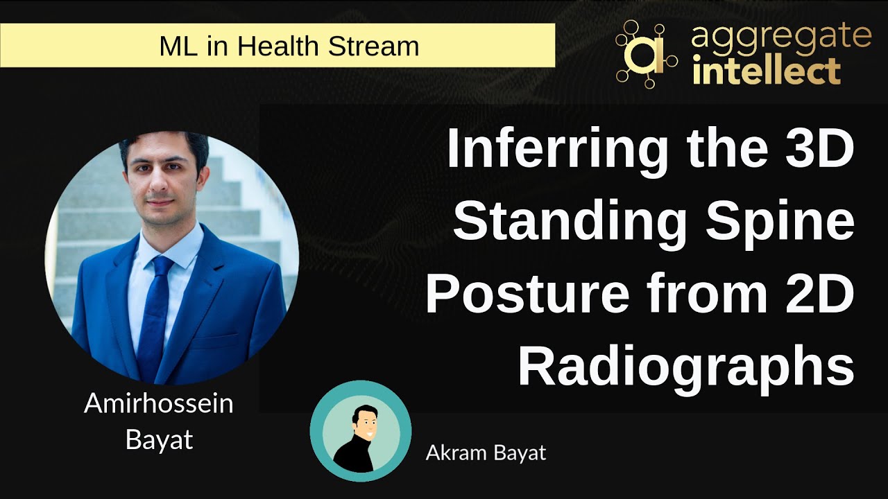 Inferring the 3D Standing Spine Posture from 2D Radiographs | AISC ...
