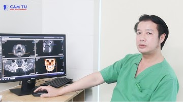 Cách tạo ra răng nhân tạo để thay thế răng thật đã bị mất | BS Hùng - Nha Khoa Cẩm Tú