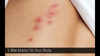 5 Signs That You Have Bed Bugs | The Bed Bugs Experts