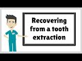 Recovering from a tooth extraction