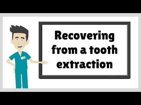 Video: What To Do After Tooth Extraction?