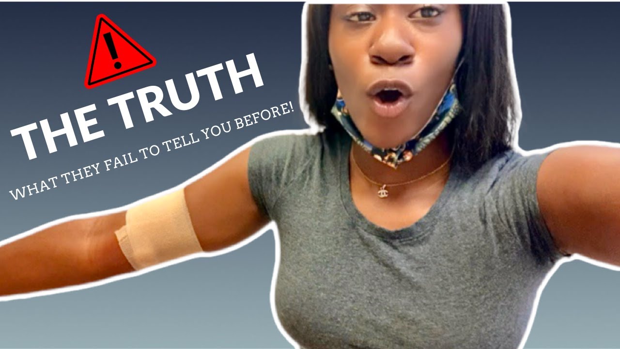 WHY I REMOVED MY NEXPLANON IMPLANT EARLY (Clips included!) YouTube