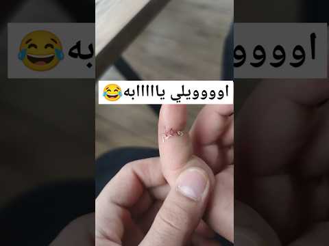 انجرحت جرح جروح روح روح ههههه العراق   بغداد اكسبلور اربيل 