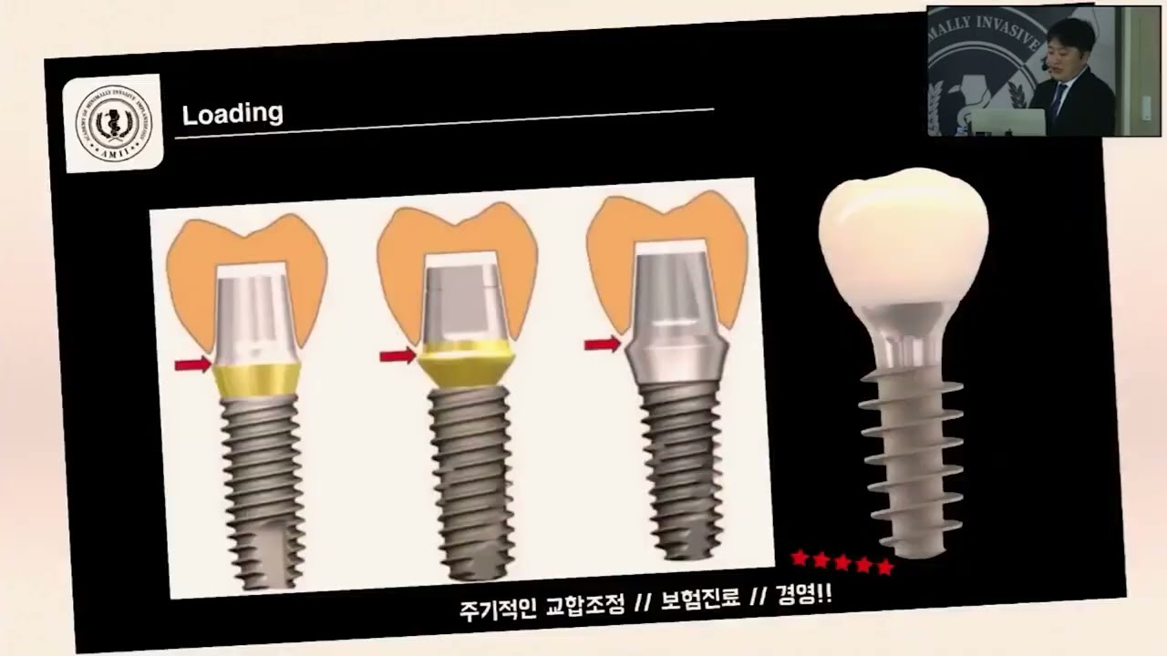 20240908 MagiCore 유지관리 - tooth mobility 장정록 (essential course)