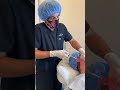 Non-surgical Skin Tightening and Facelift with FaceTite and Morpheus8, Zero Downtime