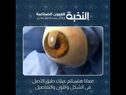 مع مركز النخبة للعيون الصناعية هتستلم عين صناعية طب الأصل فى الشكل واللون والتفاصيل