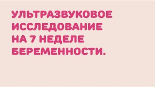 Подробно о 7 неделе беременности: что происходит, ощущения, ранний токсикоз, фото, видео   