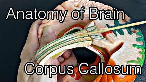 Anatomy of brain: corpus callosum (English)