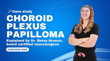 Case study 127 | Choroid Plexus Papilloma | explained by Dr. Grunch | pediatric brain tumor