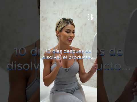 Hoy nos visita Oriana Marzoli para tratar una asimetría en labios