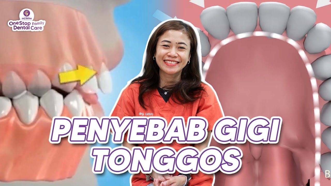 KEBIASAAN SEHARI-HARI YANG BISA BIKIN GIGI KAMU TONGGOS