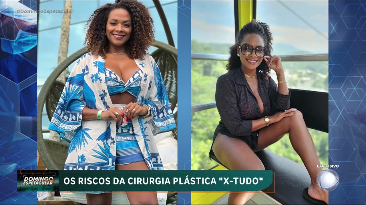 O 'Domingo Espetacular' alerta para os riscos da ‘cirurgia x-tudo’