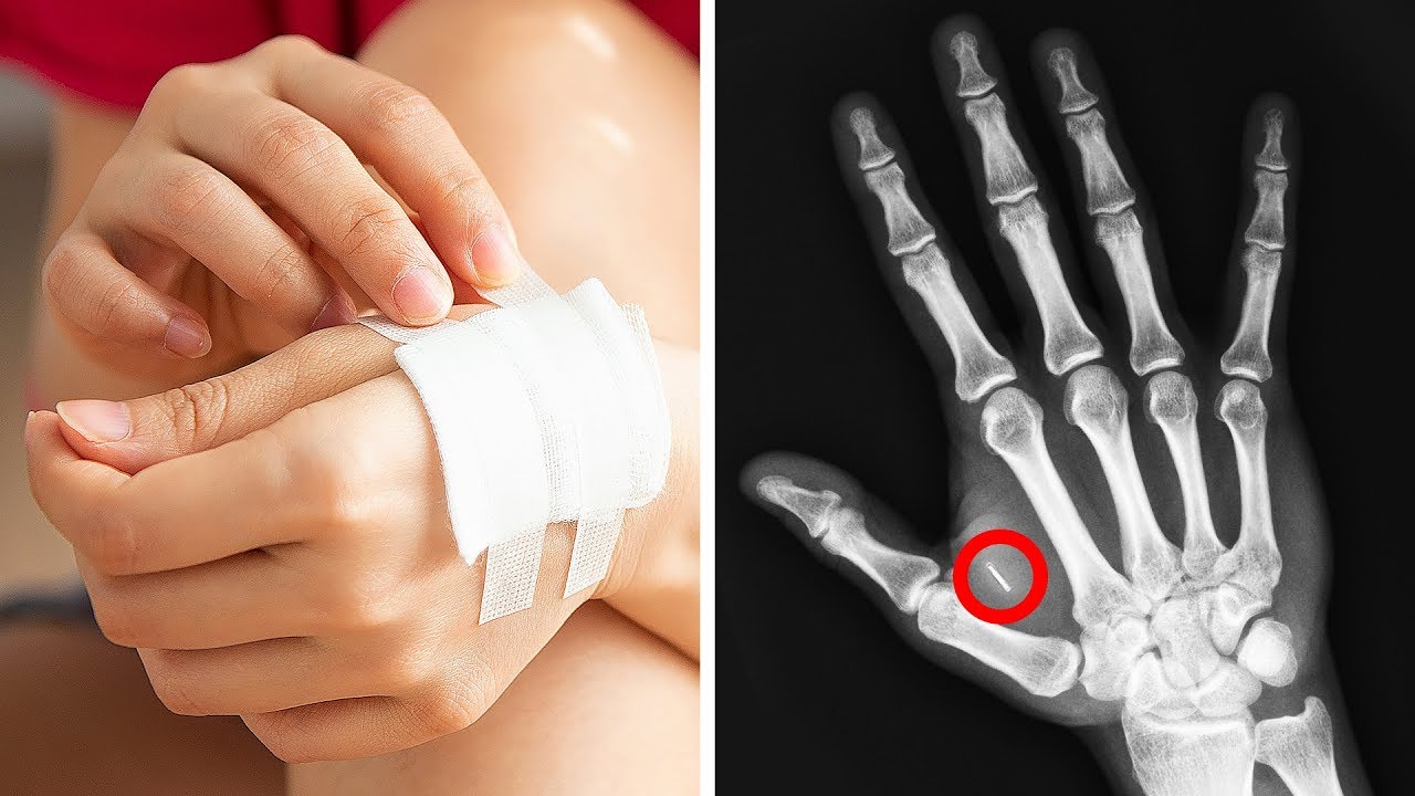 Pessoas na Suécia Têm Um chip Nas Mãos inspiração para desenhar