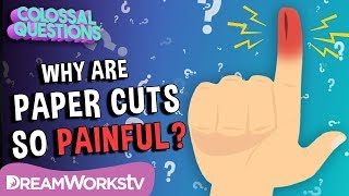 Why Do Paper Cuts Hurt So Much? Colossal Questions