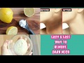 How to get rid of dark neck fast and easy way