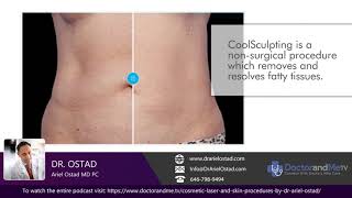 What Is Coolsculpting? Dr. Ariel Ostad Explains