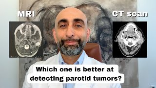 How do you detect a parotid tumor? | MRI vs CT Scan screenshot 4